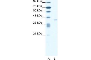 Image no. 1 for anti-Forkhead Box L2 (FOXL2) (N-Term) antibody (ABIN2777885)