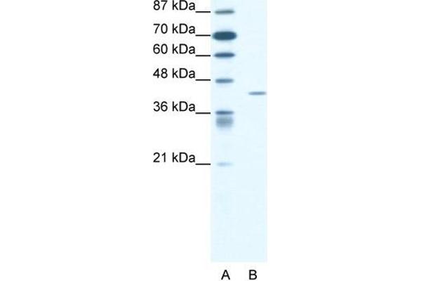anti-Forkhead Box L2 (FOXL2) (N-Term) antibody