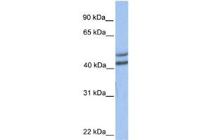 Image no. 1 for anti-Galactose-1-Phosphate Uridylyltransferase (GALT) (C-Term) antibody (ABIN2783382)