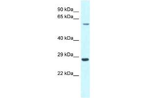 Image no. 1 for anti-Copine III (CPNE3) (C-Term) antibody (ABIN2789170)