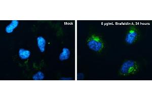 Image no. 2 for anti-Cysteine-Rich, Angiogenic Inducer, 61 (CYR61) (Center) antibody (ABIN2855676)