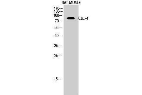 CLCN4 antibody  (Internal Region)