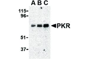 Image no. 7 for anti-Eukaryotic Translation Initiation Factor 2-alpha Kinase 2 (EIF2AK2) (C-Term) antibody (ABIN6656999)