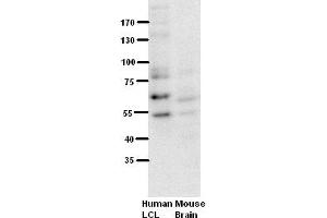 Image no. 5 for anti-Runt-Related Transcription Factor 1 (RUNX1) (Middle Region) antibody (ABIN2792598)
