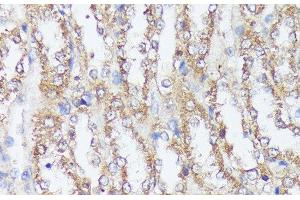 Immunohistochemistry of paraffin-embedded Rat kidney using MTHFD2 Polyclonal Antibody at dilution of 1:100 (40x lens).