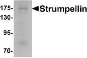 Image no. 1 for anti-WASH Complex Subunit 5 (WASHC5) (C-Term) antibody (ABIN1450091)