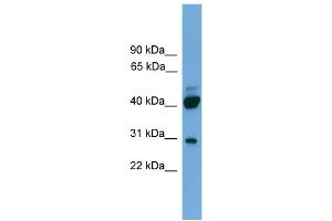 Image no. 2 for anti-Proline Rich 5 (Renal) (PRR5) (N-Term) antibody (ABIN2786881)