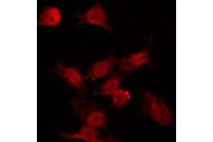 Image no. 6 for anti-serum/glucocorticoid Regulated Kinase 1 (SGK1) (pSer422) antibody (ABIN6256329)