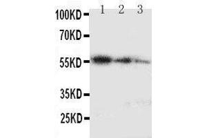 Image no. 1 for anti-Antigen Identified By Monoclonal Antibody Ki-67 (MKI67) (AA 3234-3256), (C-Term) antibody (ABIN3042997)