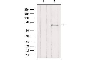 Image no. 4 for anti-Solute Carrier Family 28 (Sodium-Coupled Nucleoside Transporter), Member 2 (SLC28A2) (Internal Region) antibody (ABIN6258323)