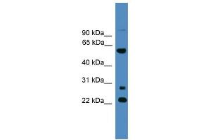 Image no. 1 for anti-Meiosis-Specific Nuclear Structural 1 (MNS1) (N-Term) antibody (ABIN2787128)
