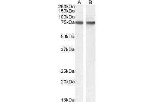 Image no. 3 for anti-Sorting Nexin 1 (SNX1) (Internal Region) antibody (ABIN571095)