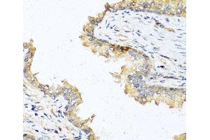 Immunohistochemistry of paraffin-embedded Human prostate using DEFB121 Polyclonal Antibody at dilution of 1:100 (40x lens).