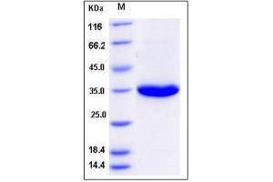 Image no. 1 for Prostate Specific Antigen (PSA) (Active) protein (ABIN1304445)