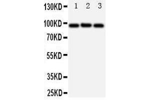 Image no. 2 for anti-ATP-Binding Cassette, Sub-Family B (MDR/TAP), Member 6 (ABCB6) (AA 818-842), (C-Term) antibody (ABIN3044283)