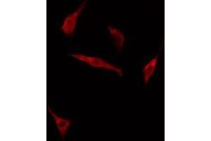 Image no. 1 for anti-Growth Factor Receptor-Bound Protein 14 (GRB14) (Internal Region) antibody (ABIN6258228)