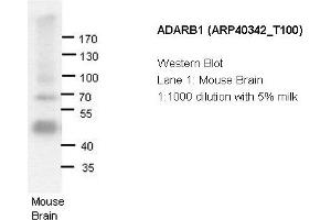 Image no. 2 for anti-Adenosine Deaminase, RNA-Specific, B1 (ADARB1) (N-Term) antibody (ABIN2778757)