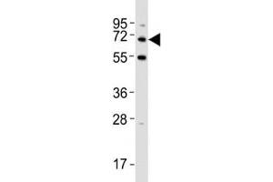 Image no. 5 for anti-Sequestosome 1 (SQSTM1) (AA 317-346) antibody (ABIN3031543)