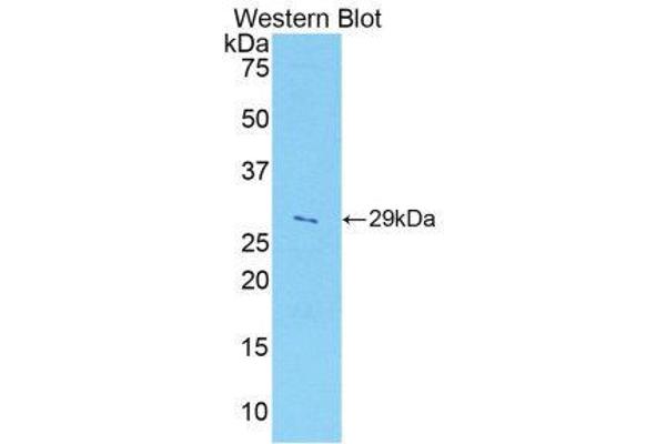 anti-A Disintegrin and Metallopeptidase Domain 5 (ADAM5) (AA 413-649) antibody
