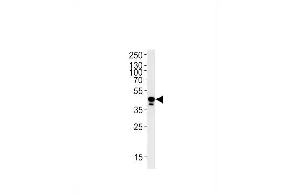 EFNB2A anticorps  (AA 163-194)