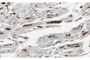 Image no. 2 for anti-Protein Phosphatase 1, Regulatory Subunit 13 Like (PPP1R13L) (AA 780-797), (Isoform 1) antibody (ABIN401339)