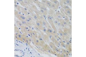 Immunohistochemistry of paraffin-embedded human liver using PTTG1 antibody.