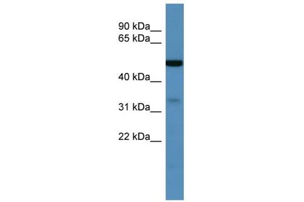 ZDHHC3 antibody  (C-Term)