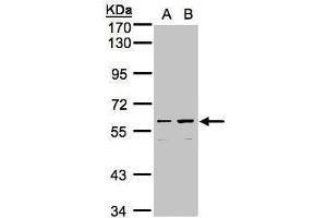 WB Image Sample (30μg whole cell lysate) A:Hep G2 , B:MOLT4 , 7.