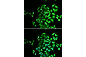 Image no. 1 for anti-N-Ethylmaleimide-Sensitive Factor Attachment Protein, gamma (NAPG) antibody (ABIN6144362)