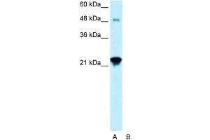 Image no. 1 for anti-Ceramide Synthase 2 (CERS2) (N-Term) antibody (ABIN2777498)
