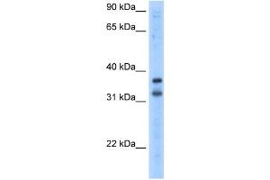 Image no. 1 for anti-Potassium Channel Regulator (KCNRG) (N-Term) antibody (ABIN2776357)