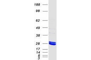 Image no. 1 for Methylmalonic Aciduria (Cobalamin Deficiency) CblB Type (MMAB) protein (Myc-DYKDDDDK Tag) (ABIN2726122)