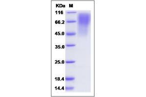 Image no. 1 for CD68 Molecule (CD68) (AA 1-295) protein (His tag) (ABIN2009458)