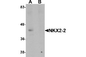 Image no. 1 for anti-NK2 Homeobox 2 (Nkx2-2) (Middle Region) antibody (ABIN1031020)