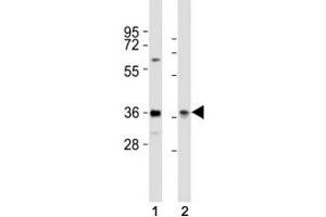 Image no. 4 for anti-Paired Box 4 (PAX4) (AA 171-200) antibody (ABIN3032125)