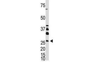 Image no. 1 for anti-Dickkopf Homolog 4 (Xenopus Laevis) (DKK4) (AA 7-36), (N-Term) antibody (ABIN357073)