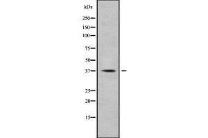 Image no. 1 for anti-Dihydrodiol Dehydrogenase (DDH) antibody (ABIN6259861)