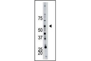 Image no. 1 for anti-6-phosphofructo-2-Kinase/fructose-2,6-Biphosphatase 4 (PFKFB4) (AA 274-303) antibody (ABIN360670)