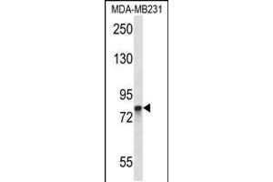 Image no. 1 for anti-Peptidyl Arginine Deiminase, Type II (PADI2) (AA 557-586), (C-Term) antibody (ABIN5531793)