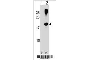 Image no. 1 for anti-Ras Homolog Family Member G (RHOG) (C-Term) antibody (ABIN2496251)