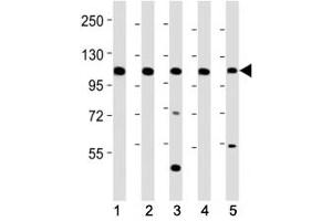 Image no. 3 for anti-C-Mer Proto-Oncogene Tyrosine Kinase (MERTK) (C-Term) antibody (ABIN3030226)