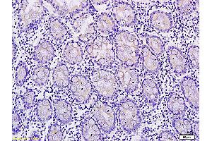 Image no. 1 for anti-Met Proto-Oncogene (MET) (pTyr1365) antibody (ABIN733658)