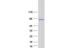 Image no. 1 for Carboxylesterase 3 (CES3) protein (Myc-DYKDDDDK Tag) (ABIN2713934)