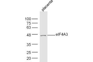 Image no. 2 for anti-Eukaryotic Translation Initiation Factor 4A3 (EIF4A3) (AA 351-411) antibody (ABIN5675217)