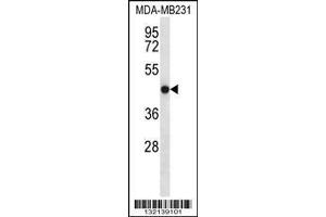 Image no. 1 for anti-Transmembrane Protein 43 (TMEM43) (AA 195-223) antibody (ABIN656549)