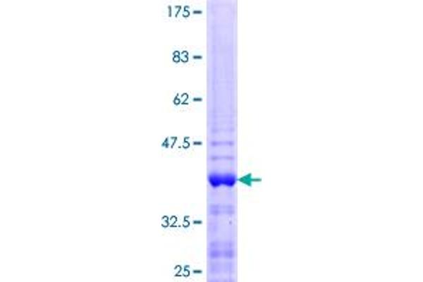 ZNF75A Protein (AA 58-162) (GST tag)