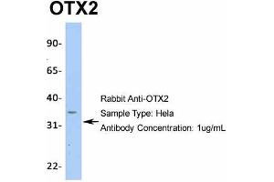 Image no. 4 for anti-Orthodenticle Homeobox 2 (OTX2) (N-Term) antibody (ABIN2779643)