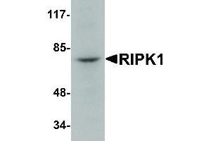 Image no. 1 for anti-Receptor (TNFRSF)-Interacting serine-threonine Kinase 1 (RIPK1) (N-Term) antibody (ABIN6657128)