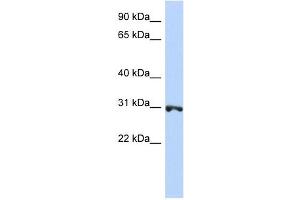 Image no. 1 for anti-Ring Finger Protein 126 (RNF126) (N-Term) antibody (ABIN631373)