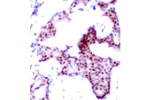 Image no. 3 for anti-Nuclear Factor-kB p65 (NFkBP65) (pSer276) antibody (ABIN1682005)
